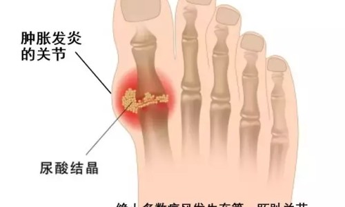 葵花小儿氨酚烷胺颗粒和小儿氨酚黄那敏颗粒有什么区别专区_葵花小儿氨酚烷胺颗粒图片专区_葵花小儿氨酚烷胺颗粒网